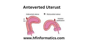 Anteverted Uterus: Is it Normal?