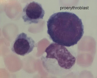 proerythroblast