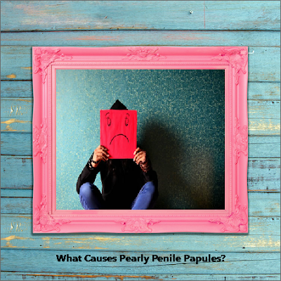 What Causes Pearly Penile Papules?