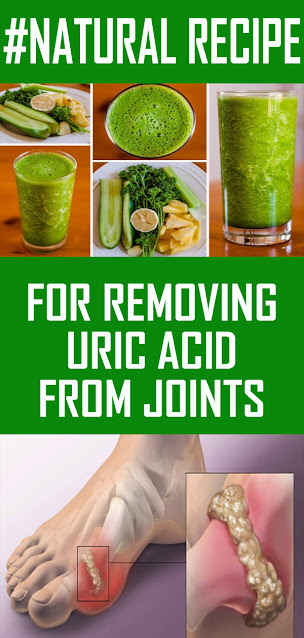 Natural Recipe For Removing Uric Acid From Your Joints
