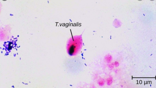 Trichomonas vaginalis in urogenital specimen