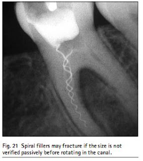 Spiral root canal fillers