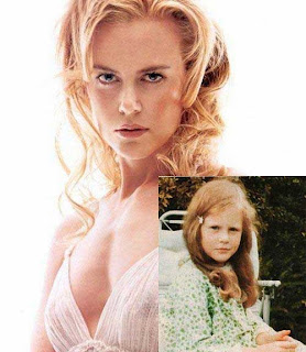 Childhood Pictures of Nicole Kidman