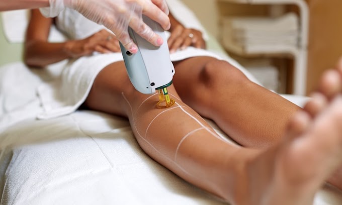 Get Rid Of Unwanted Face & Body Hair With Laser Hair Removal