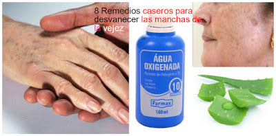  elimina-manchas-de-la-mano