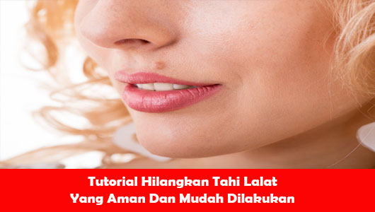 Tutorial Hilangkan Tahi Lalat Yang Aman Dan Mudah Dilakukan