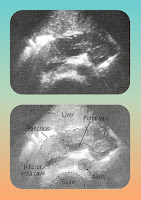 Pancreas | Common Errors, Locations & Abnormalities