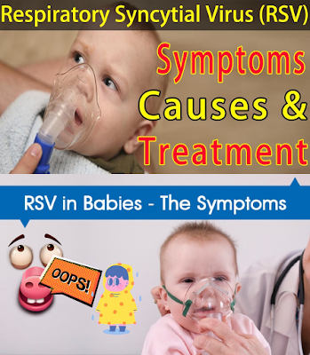 RSV Symptoms Baby and Treatment
