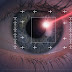 Lasik Surgery ( Bedah Lasik )