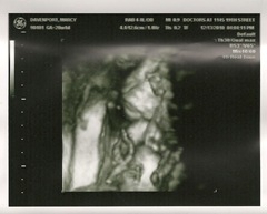 baby 20 weeks 2