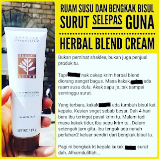 Krim Ruam Susu Peluh Lampin Gatal Bayi Di Muka Leher Pipi