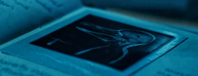 Inside the notebook is an X-ray of a half-bird hybrid human. In addition, there are notes on what parts of the hybrid humans were taken for research. Starting from the bone marrow to the blood is researched to be developed into an anti-virus drug H5G9.