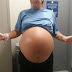คุณแม่ท้องโต ให้กำเนิดทารกหนัก ถึง (6 กิโลกรัม)