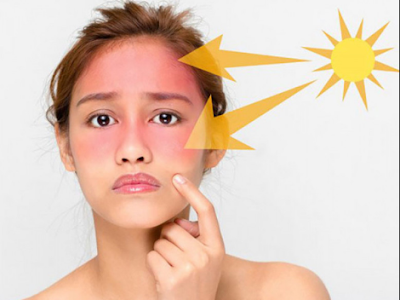 Khi tiếp xúc với ánh nắng mặt trời quá nhiều tăng nguy cơ mắc các bệnh về mắt nguy hiểm