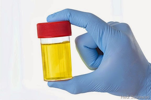 Kandungan-Komposisi Urine Primer, Sekunder, dan Sesungguhnya