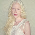 What does the word Albino Mean?