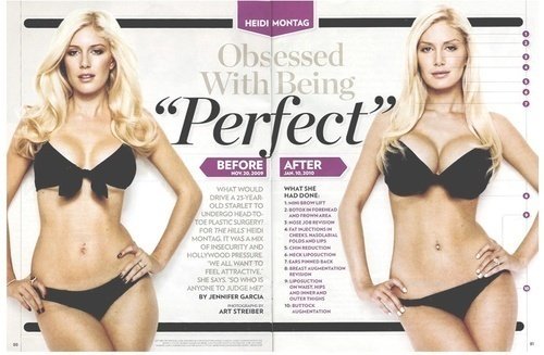 heidi montag before and after. heidi montag before and after