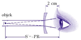 Bayangan benda jauh yang dibentuk lensa untuk miopi harus jatuh di titik jauh mata