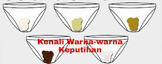 warna-warna keputihan