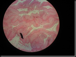 TCC  high resolution histology slide tsnaps