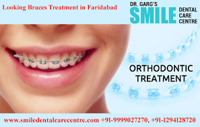 Best Orthodontist Braces Treatment in Faridabad