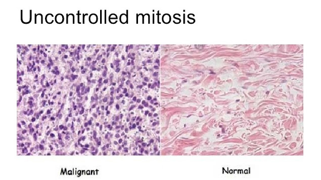 Mitosis-celular-descontrolada-o-carcinogenesis