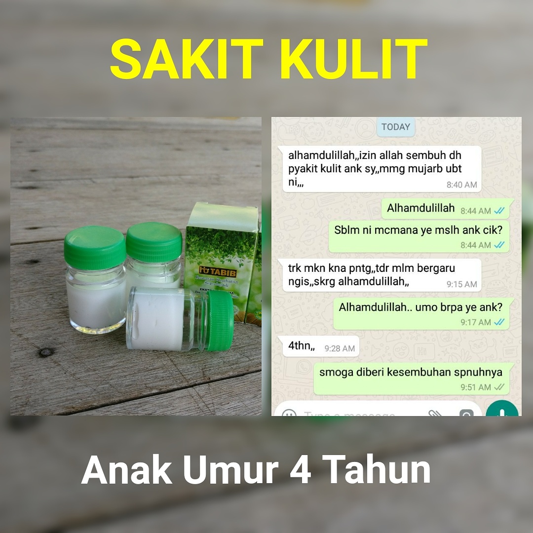 KRIM GATAL KULIT HERBA RERAMA :- Merawat Masalah Gatal² 