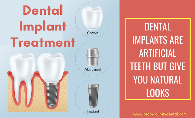 dental-Implant-treatment-brampton