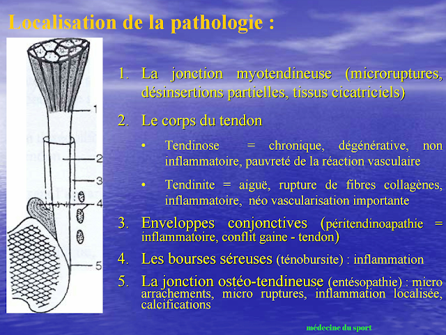 LÉSIONS MUSCULAIRES