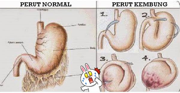 Hati-Hati Kalau Kamu “Sering Mengalami Perut Kembung”, Siapa Sangka Ternyata Perut Kembung Itu Gejala dari “Penyakit Berbahaya Ini”