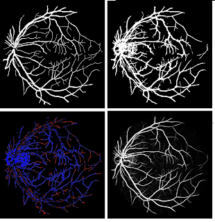 heart and blood vessels journal