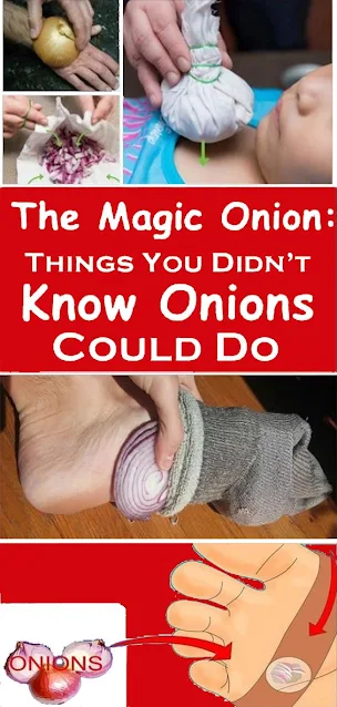 10 Illnesses That Can Be Cured By Onions
