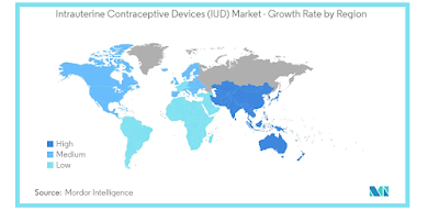 Mercado Intra-uterino contraceptivo Devices (DIU): a indústria global busca alto crescimento até 2021-2023