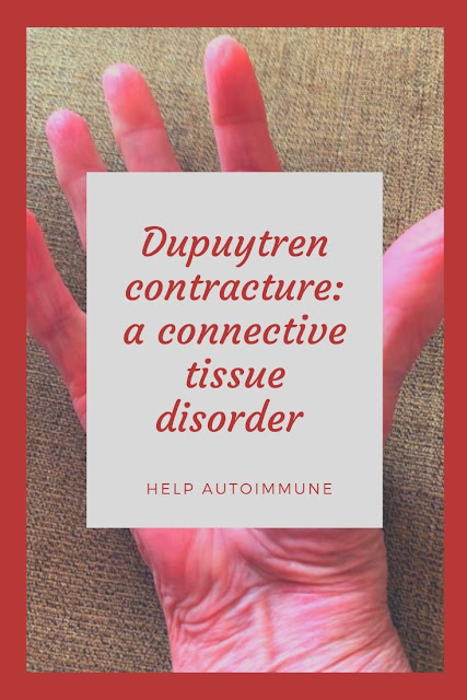 Dupuytren contracture