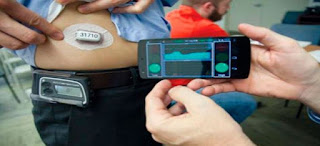 Artificial-Pancreas