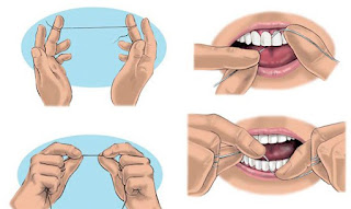 flossing with braces, How to Floss Teeth with Braces?, Braces pain