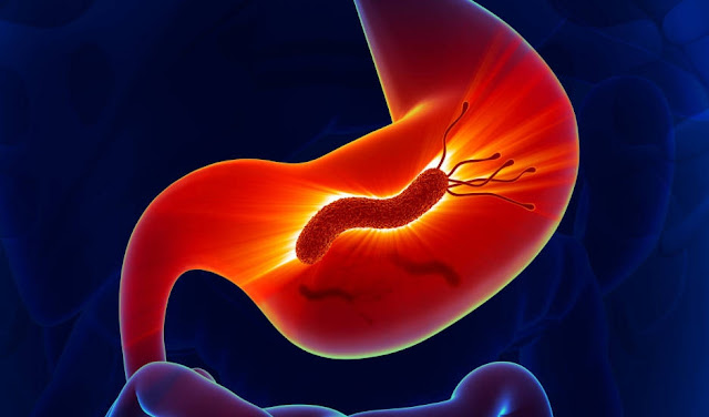 Helicobacter_pylori_the_cause_of_stomach_cancer