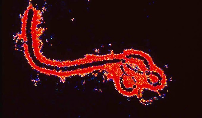 Japão desenvolve medicamentos Favipiravir e T-705 contra o vírus ebola