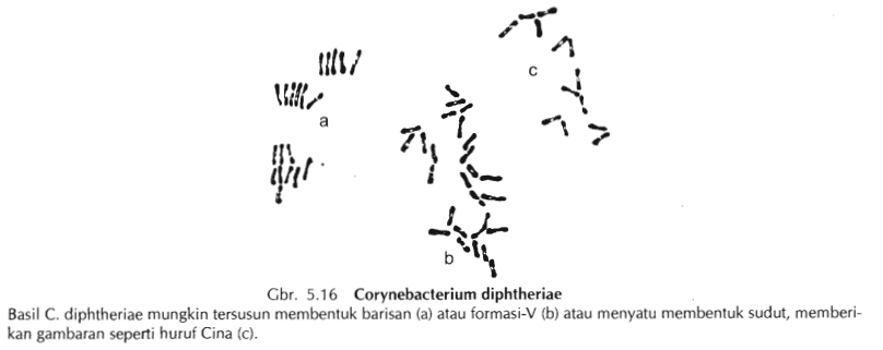 Pewarnaan Albert Untuk Pendeteksian Corynobacterium 