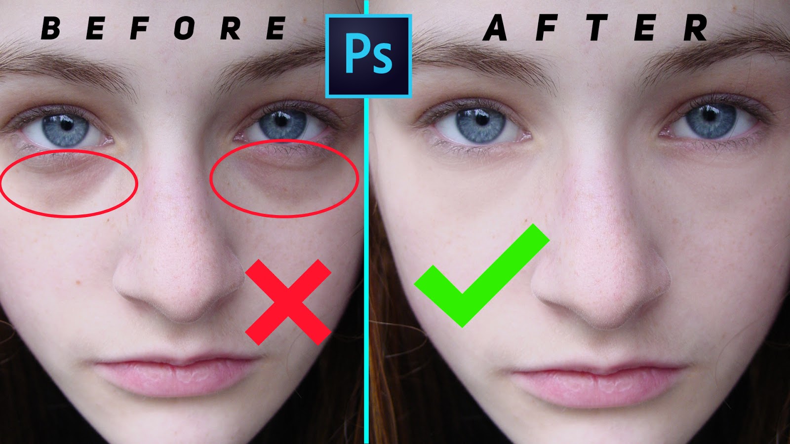 How to Remove Eye bags and Eye Dark Circle in