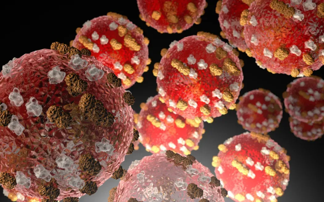 Virus sởi, CDC Hoa Kỳ cho biết bệnh sởi rất dễ lây lan và có thể nghiêm trọng, và bất kỳ ai không được bảo vệ khỏi loại virus này đều có nguy cơ mắc bệnh. Virus sởi, CDC Hoa Kỳ cho biết bệnh sởi rất dễ lây lan và có thể nghiêm trọng, và bất kỳ ai không được bảo vệ khỏi loại virus này đều có nguy cơ mắc bệnh.