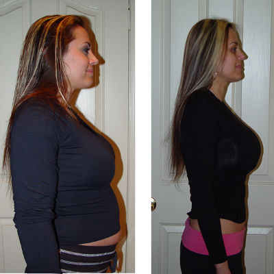 HCG Diet Program on Stephanie