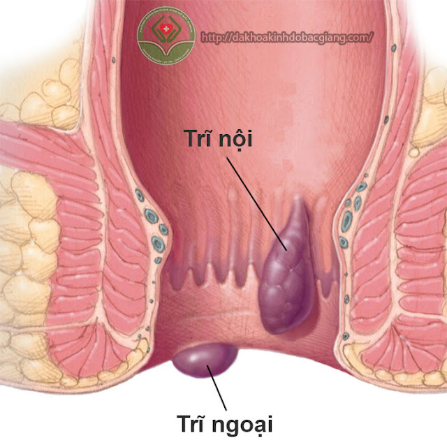 benh-tri