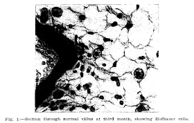 Hofbauer Cells - 1925