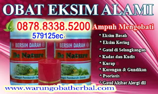 Obat Eksim Ampuh - De Nature Indonesia