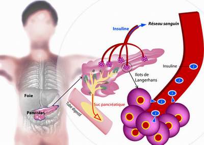 Không mập vẫn có khả năng bị tiểu đường