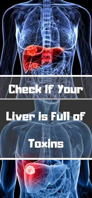 Why Headaches, Fatigue, Bad Breath and Joint Pain Are ALL Signs Your Liver is in TOXIC Overload