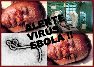 ebola virus 2014 