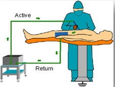 Electrosurgical Unit Mono Polar Mode patient Connection 