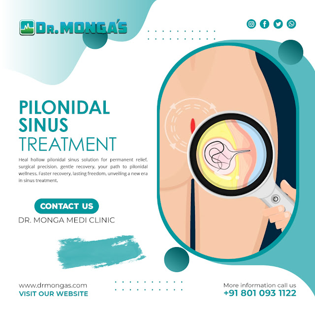 Pilonidal Sinus Treatment in Dwarka